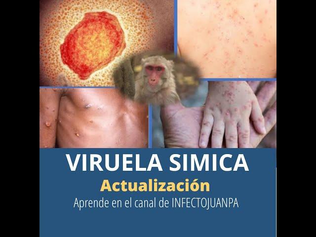 Actualización de Viruela Simica