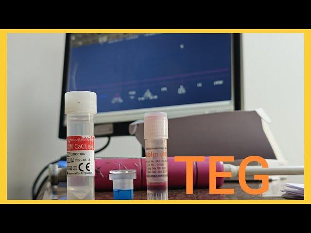 How to do TEG Blood Test | Thrombo Elastro Graphy | TEG | Hemostasis | OT Technician | OT