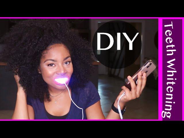 BEST TEETH WHITENING KIT AT HOME - HONEST REVIEW (ISMILE CALIFORNIA)