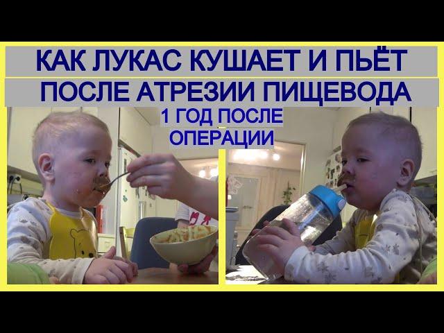 Как Лукас кушает и пьёт после атрезии пищевода. Год после операции
