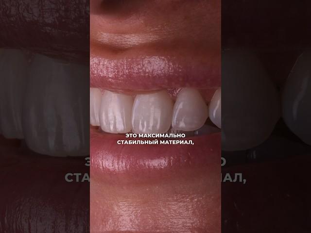 ВИНИРЫ ТЕМНЕЮТ ? /  Запись на консультацию +7-499-951-03-03 #виниры #стоматология