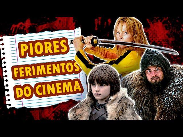 Piores ferimentos (não mortais!) do Cinema | ROBOTOP