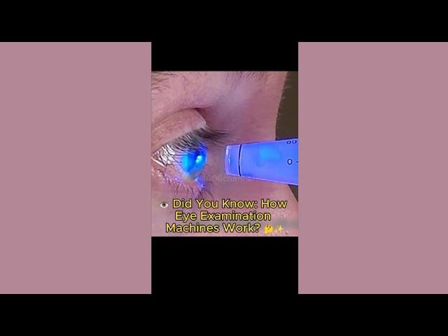 0020.  ️ Did You Know How Eye Examination Machines Work 
