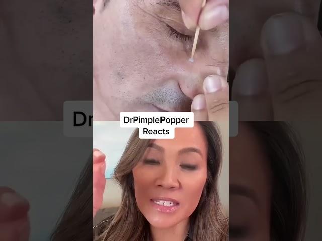 Dr Pimple Popper Reacts to Restaurant Pop!