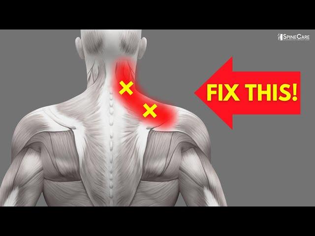 How to Fix One-Sided Neck and Shoulder Pain FOR GOOD