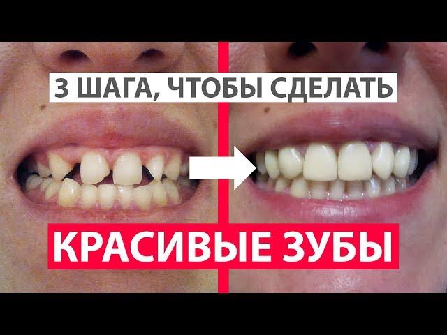 КАК СДЕЛАТЬ КРАСИВЫЕ ЗУБЫ? 3 ШАГА. БРЕКЕТЫ И РЕСТАВРАЦИЯ ЗУБОВ. ЦЕНЫ. ЗДОРОВАЯ ПОМОЩЬ #healthy_help