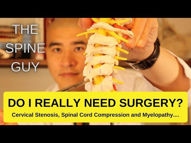 Cervical Stenosis, Spinal Cord Compression and Myelopathy.  DO I REALLY NEED SURGERY?