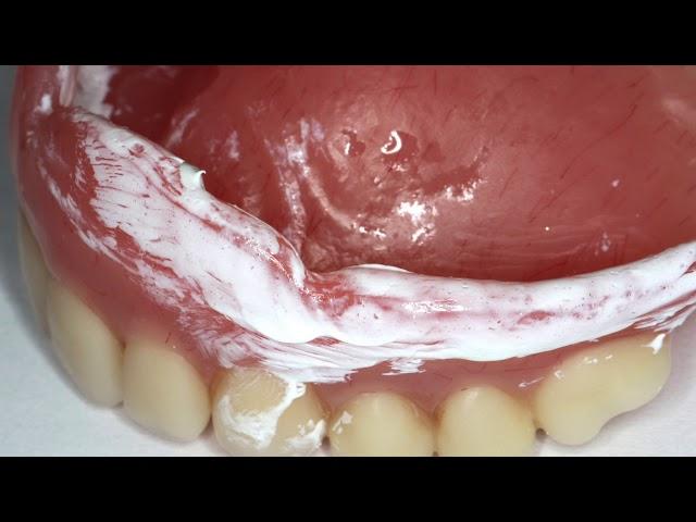 Complete Denture Base Adjustment