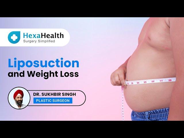 Can you lose weight with Liposuction? | | HexaHealth Expert