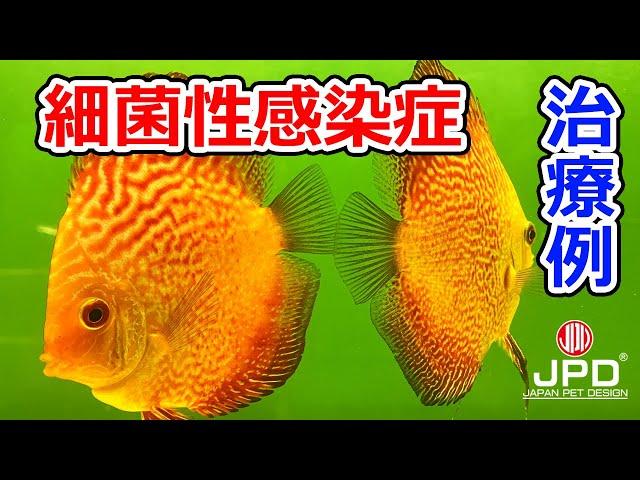 【病気の治療】細菌性感染症-ディスカス