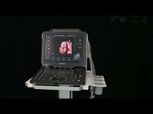 DW P5PRO Baby color doppler ultrasound system