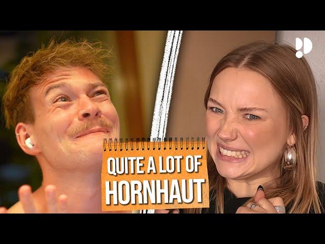 Quite a lot of Hornhaut | Die Nervigen Folge #116