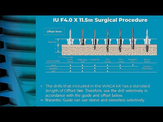 [warantec] Warantec’s Clinical Surgery Video with Digital Guide