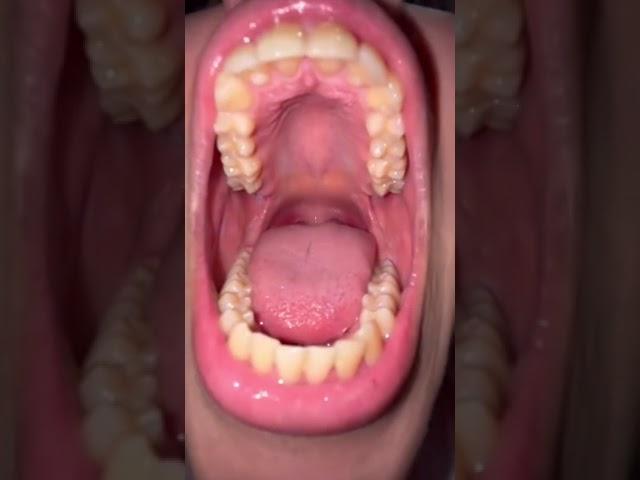 beautiful mouth view