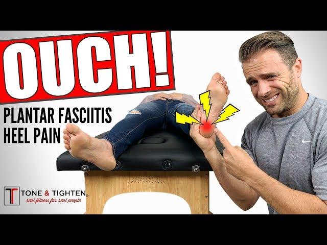 HEEL PAIN - GONE! How To Treat Plantar Fasciitis At Home