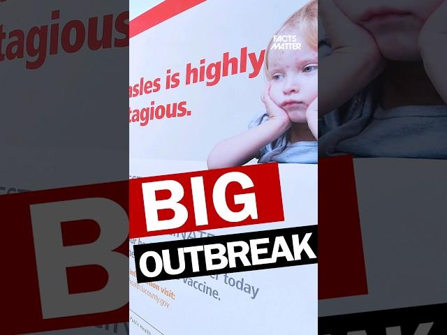 Measles Outbreak 