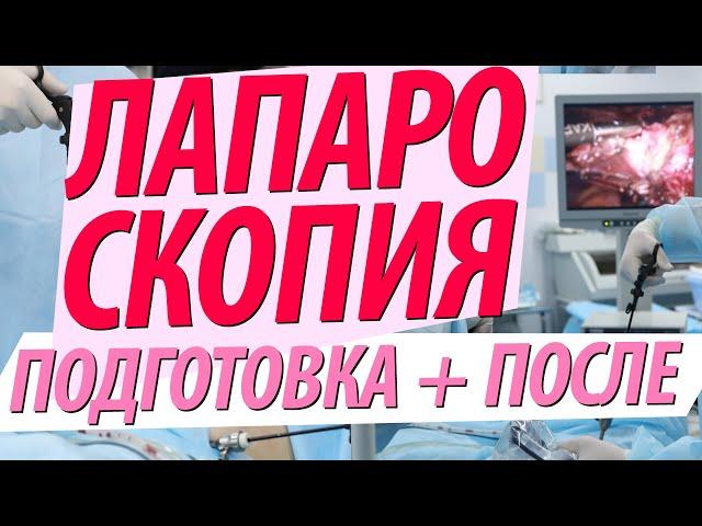 ЛАПАРОСКОПИЯ: подготовка, как проводится, после операции