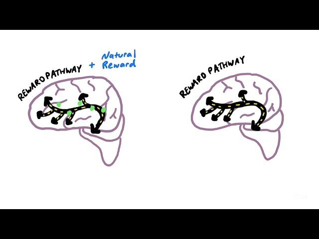 How an Addicted Brain Works