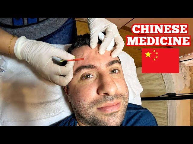 AMERICAN Tries CHINESE Medicine in China! IS IT WORTH IT? 