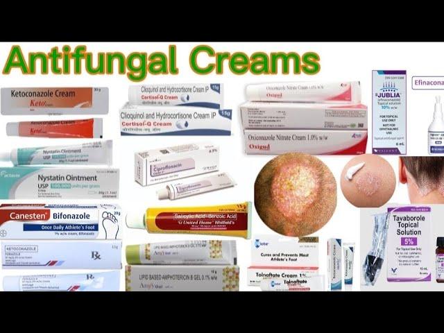 Antifungal cream |Best antifungal creams|Ringworm treatment |Skin treatment