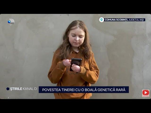 Stirile Kanal D - Povestea tinerei cu o boala genetica rara! | Editie de seara