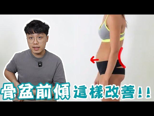 骨盆前傾害你腰痛難久站！？你該這樣改善！