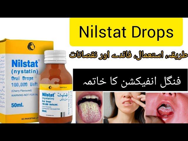 nilstat drops uses in urdu | nilstat drops how to use | nilstat drops uses for babies |