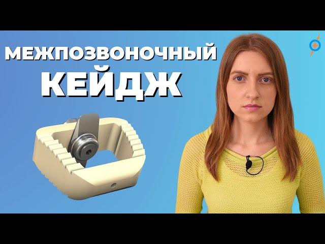 Роль МЕЖПОЗВОНОЧНОГО КЕЙДЖА при удалении ГРЫЖИ ПОЗВОНОЧНИКА #меднавигатор