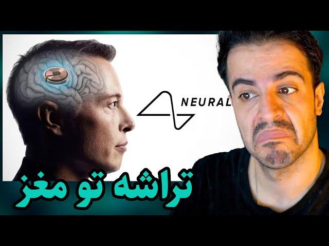 Neuralink :: داستان تراشه‌ی تو مغز ایلان ماسک چیه؟‌