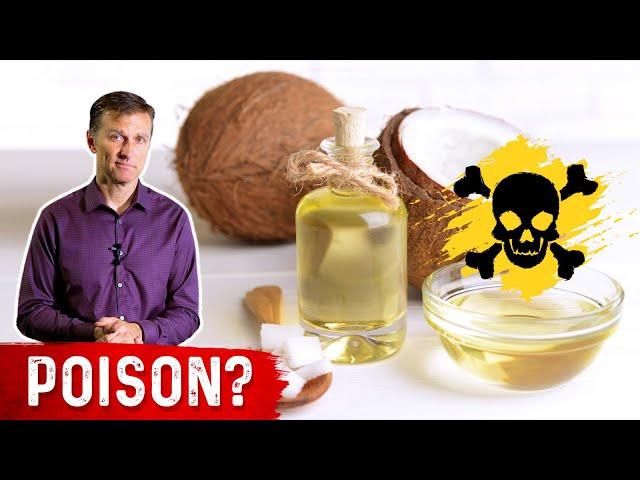 Coconut Oil: Is Coconut Oil Good For You? – Dr. Berg on the Health Benefits Of Coconut Oil