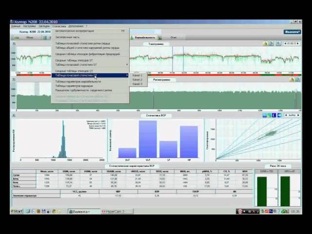 Обзор закладок в ПО Валента по холтеровскому мониторированию ЭКГ