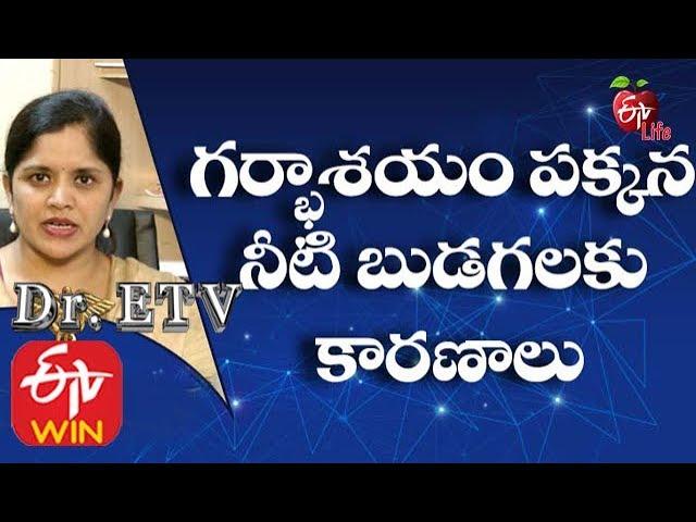 PCOS - Treatment | Dr ETV | 23rd January 2020 | ETV Life