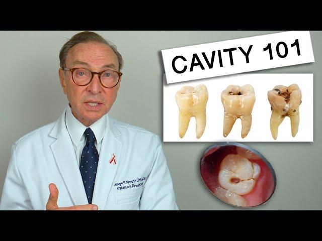 What Causes Tooth Decay? Cavity 101 | Causes | Treatment