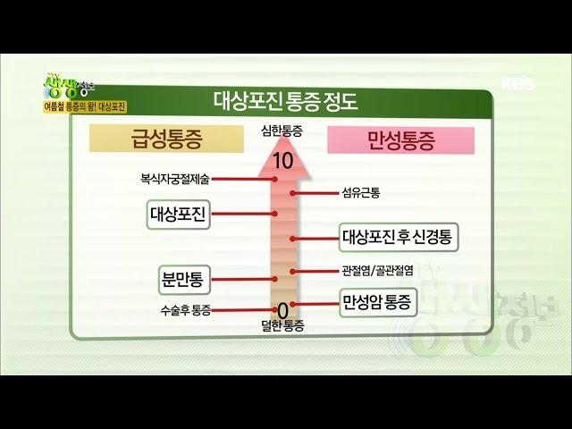 2TV 생생정보 - 여름철 통증의 왕! 대상포진.20160822