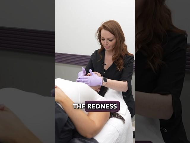 Minimize skin redness with this treatment! #redness