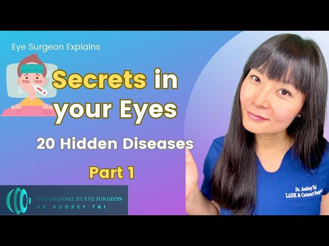 20 Hidden Diseases Revealed by Eye Exams | Part 1| Eye Surgeon Explains #draudreytai