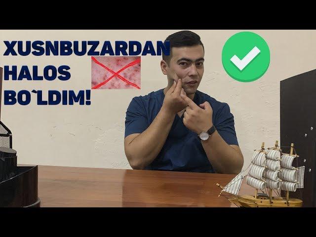 Xusnbuzardan halos bo`lish sirlari | Хуснбузардан халос булиш сирлари