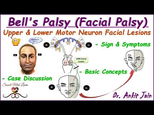 Bell's palsy/ Upper and Lower motor neuron facial palsy/ Central facial palsy/Anatomy/ Simplified