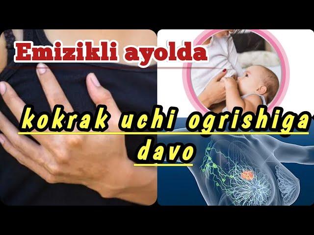 Emizikli ayolda Kokrak yorilsa emizganda ogrisa uy sharoitida davo 100% Эмизикли аёлда Кокрак огриса