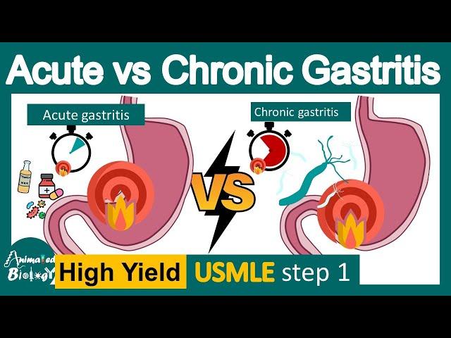 Acute vs chronic gastritis | pathology of gastritis | USMLE step 1