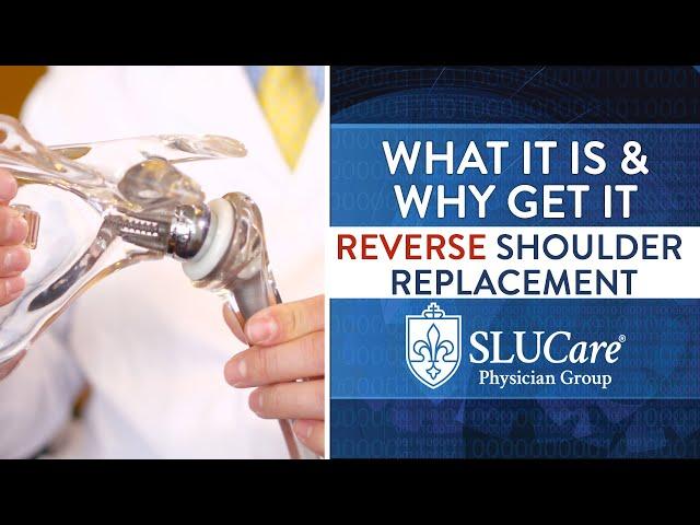 What Is A Reverse Shoulder Replacement? - SLUCare Orthopedic Surgery