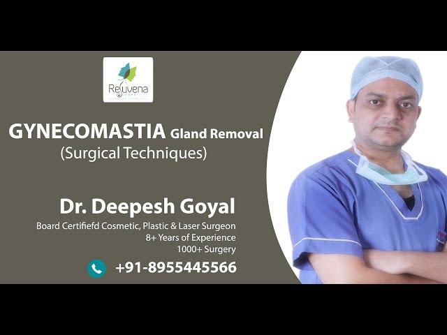 GYNECOMASTIA GLAND REMOVAL SURGERY IN JAIPUR  By Dr. DR. DEEPESH GOYAL @ REJUVENA COSMO CARE