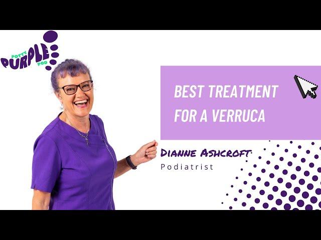 Best treatment for a verruca