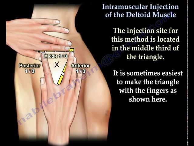 Deltoid Intramuscular injection - Everything You Need To Know - Dr. Nabil Ebraheim