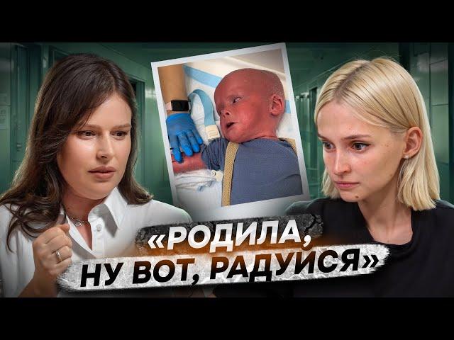 «Такие дети не живут» | Ихтиоз Арлекина