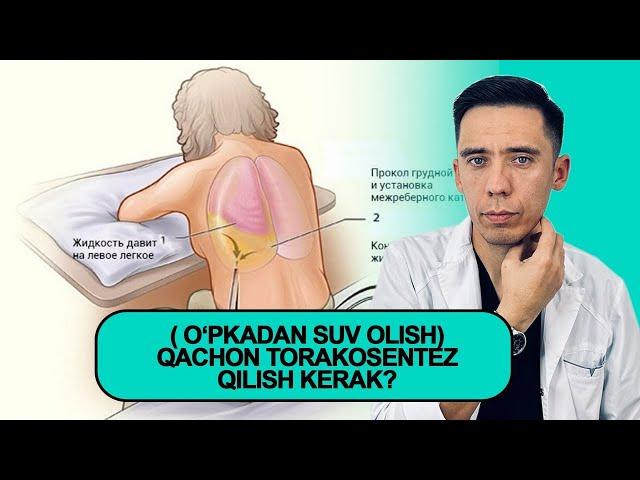 ( oʻpkadan suv olish) Qachon torakosentez qilish kerak? 