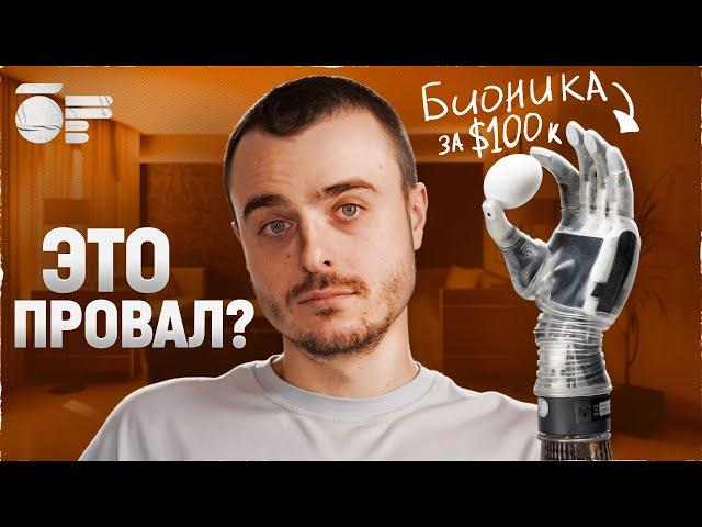 Самый дорогой протез руки в мире. Что с ним не так?