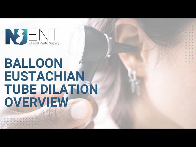 Balloon Eustachian Tube Dilation Overview | We Nose Noses