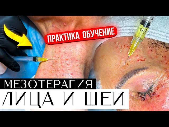 Мезотерапия Лица и шеи - ПРАКТИКА ОБУЧЕНИЕ. Видео урок.