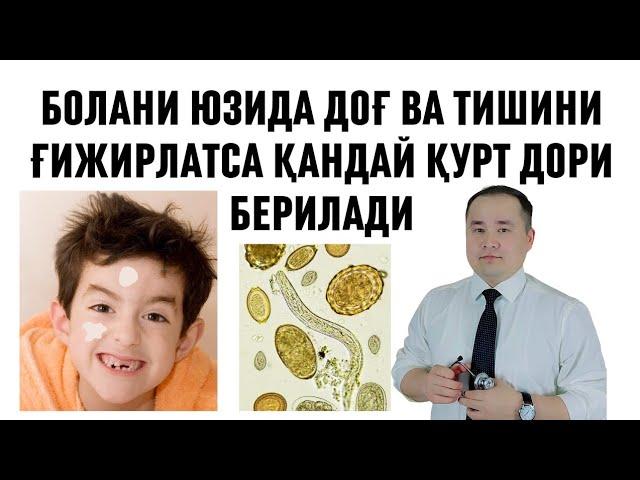 БОЛА ЮЗИДА ОҚ ДОҒ БЎЛСА ЁКИ ТИШИНИ ҒИЖИРЛАТСА ГИЖЖАГА ФАРШИ НИМА ДОРИ БЕРИШ КЕРАК ҲАҚИДА ИСЧАНОВ